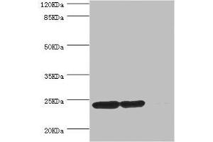 Western blot All lanes: DTYMK antibody at 5. (DTYMK anticorps  (AA 1-212))
