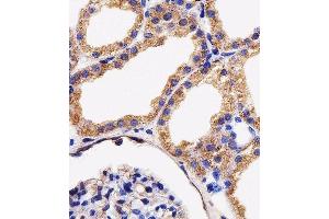 Immunohistochemical analysis of paraffin-embedded H.