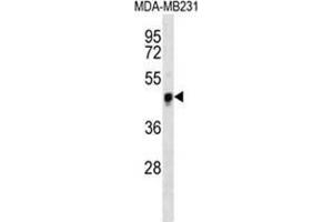 YAP Antibody western blot analysis in MDA-MB231 cell line lysates (35 µg/lane). (YAP1 anticorps  (Middle Region))