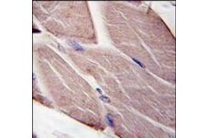 Formalin-fixed and paraffin-embedded human skeletal muscle tissue reacted with PDK4, which was peroxidase-conjugated to the secondary antibody, followed by DAB staining. (PDK4 anticorps  (Middle Region))
