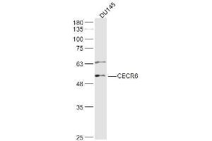 DU145 lysates probed with CECR6 Polyclonal Antibody, Unconjugated  at 1:500 dilution and 4˚C overnight incubation. (CECR6 anticorps)
