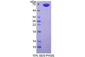 SDS-PAGE (SDS) image for Carboxypeptidase A3 (Mast Cell) (CPA3) (AA 110-417) protein (His tag,GST tag) (ABIN1878716)