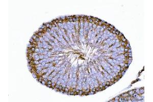 IHC analysis of TRBP/TARBP2 using anti-TRBP/TARBP2 antibody (ABIN7600548). (TARBP2 anticorps  (AA 20-366))