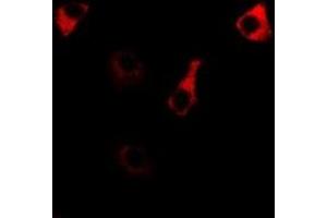 Immunofluorescent analysis of RPS14 staining in MCF7 cells.