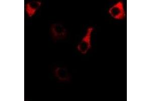 Immunofluorescent analysis of RPS14 staining in MCF7 cells. (RPS14 anticorps)