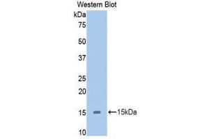 Western Blotting (WB) image for anti-Slit Homolog 2 (Drosophila) (SLIT2) (AA 1416-1528) antibody (ABIN1860579)