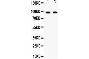 Observed bind size: 90KD (KIAA1524 anticorps  (C-Term))