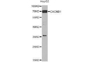 Western blot analysis of extracts of HepG2 cells, using CACNB1 Antibody (ABIN5975152) at 1/1000 dilution. (CACNB1 anticorps)