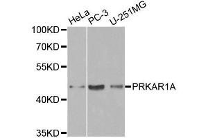 Western blot analysis of extracts of various cell lines, using PRKAR1A antibody.