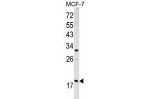 Image no. 1 for anti-ADP-Ribosylation Factor 3 (ARF3) (Middle Region) antibody (ABIN452754) (ARF3 anticorps  (Middle Region))