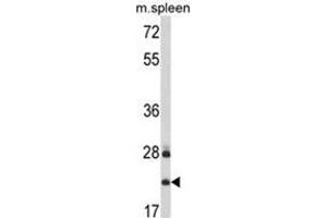 Western blot analysis of VTI1A Antibody (C-term) in mouse spleen tissue lysates (35ug/lane). (VTI1A anticorps  (C-Term))