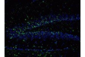 Immunostaining of mouse dentate gyrus 48 hour post TMT treatment showing NR2B when phosphorylated at Tyr1336 in green and nuclei in blue. (GRIN2B anticorps  (pTyr1336))