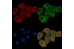 FAS Mouse Monoclonal Antibody staining Hela cells by IF/ICC. (FAS anticorps  (C-Term))