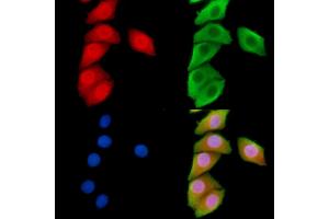 ABIN6266100 and ABIN6278545 staining Hela cells by IF/ICC. (ZNF598 anticorps  (N-Term))