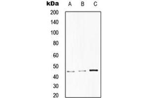 Western blot analysis of CD75 expression in HepG2 (A), HeLa (B), RAW264. (ST6GAL1 anticorps  (Center))