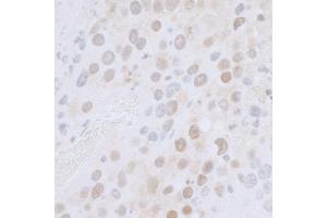 Immunohistochemistry (IHC) image for anti-RNA Polymerase-Associated Protein CTR9 Homolog (CTR9) (AA 1123-1173) antibody (ABIN7453428) (CTR9 anticorps  (AA 1123-1173))