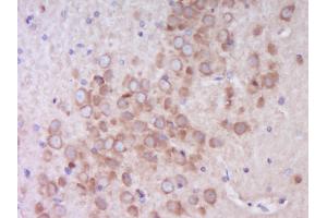 Paraformaldehyde-fixed, paraffin embedded Rat brain Antigen retrieval by boiling in sodium citrate buffer (pH6.