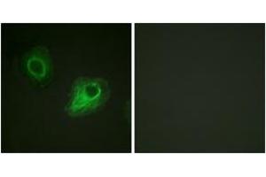 Immunofluorescence analysis of HeLa cells, using VEGFR2 (Ab-1054) Antibody. (VEGFR2/CD309 anticorps  (AA 1020-1069))