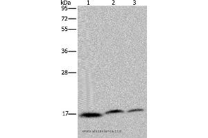 Western blot analysis of Jurkat, Hela and K562 cell, using NDUFAF4 Polyclonal Antibody at dilution of 1:350 (NDUFAF4 anticorps)