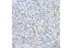 Immunohistochemistry of paraffin-embedded Rat ovary using FD Rabbit pAb (ABIN7267116) at dilution of 1:50 (40x lens). (FAM3D anticorps  (AA 24-204))