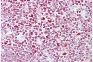 Anti-NFATC3 antibody IHC staining of human thymus. (NFATC3 anticorps  (AA 324-373))
