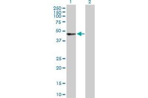 Western Blot analysis of UBASH3A expression in transfected 293T cell line by UBASH3A MaxPab polyclonal antibody. (UBASH3A anticorps  (AA 1-451))