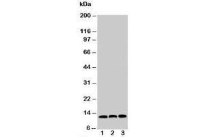 Western blot testing of MIF antibody and Lane 1:  HeLa;  2: COLO320;  3: MM231 cell lysate (MIF anticorps  (C-Term))