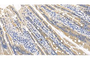 Detection of RIPK1 in Rat Small intestine Tissue using Polyclonal Antibody to Receptor Interacting Serine Threonine Kinase 1 (RIPK1)