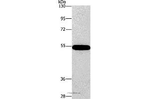 Western blot analysis of 293T cell, using CNDP1 Polyclonal Antibody at dilution of 1:320 (CNDP1 anticorps)