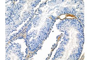 ABIN7093245 and ABIN7097262 at 1/100 staining Mouse testis tissue by IHC-P. (DPYSL2 anticorps  (pSer522))