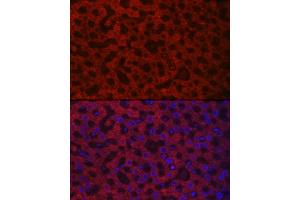Immunofluorescence analysis of rat liver cells using H/GOX Rabbit pAb (ABIN6131795, ABIN6141599, ABIN6141600 and ABIN6222127) at dilution of 1:100 (40x lens).