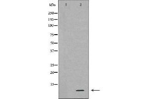 Western blot analysis of extracts of HL-60 , using RPS27A antibody. (RPS27A anticorps  (Internal Region))