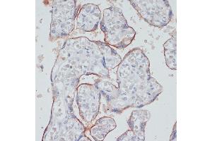 Immunohistochemistry of paraffin-embedded human placenta using CD71/Transferrin Receptor antibody (ABIN6131555, ABIN6149065, ABIN6149066 and ABIN6221572) at dilution of 1:100 (40x lens).