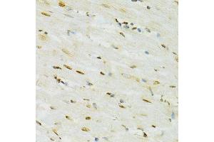 Immunohistochemistry of paraffin-embedded rat heart using ADAR antibody.