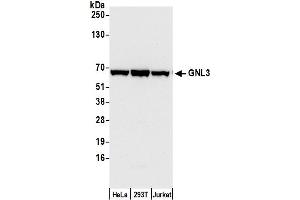 Western Blotting (WB) image for anti-Guanine Nucleotide Binding Protein-Like 3 (Nucleolar) (GNL3) (C-Term) antibody (ABIN7453884) (Nucleostemin anticorps  (C-Term))