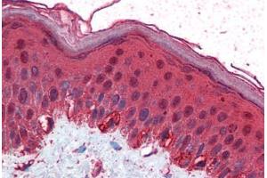 Human Skin (formalin-fixed, paraffin-embedded) stained with TFAP2C antibody ABIN351479 at 2. (TFAP2C anticorps  (AA 270-281))