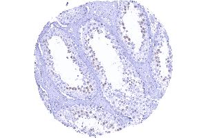 anti-Thymidylate Synthetase (TYMS) (Center) antibody