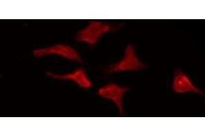 ABIN6275381 staining Hela by IF/ICC. (KCNF1 anticorps  (Internal Region))