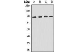 Western blot analysis of p62 expression in Hela (A), Jurkat (B), mouse liver (C), mouse kidney (D) whole cell lysates. (KHDRBS1 anticorps)