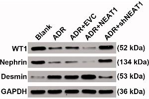 The expression levels of podocyte injury makers including WT1, Nephrin and Desmin in the MPC5 cells in five groups were quantified by western blot and the internal reference was GAPDH.