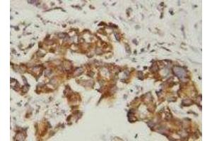 anti-Superoxide Dismutase (AA 113-129) antibody