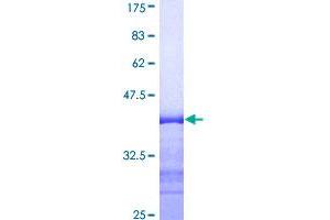Image no. 1 for Myocilin (MYOC) (AA 36-135) protein (GST tag) (ABIN1311844)