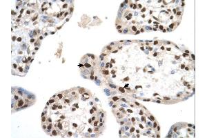 SETD2 antibody was used for immunohistochemistry at a concentration of 4-8 ug/ml.