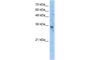 Western Blotting (WB) image for anti-Solute Carrier Family 25 (Mitochondrial Carrier, Graves Disease Autoantigen), Member 16 (SLC25A16) antibody (ABIN2462778) (SLC25A16 anticorps)