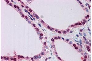 Human Thyroid: Formalin-Fixed, Paraffin-Embedded (FFPE)