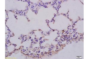 Formalin-fixed and paraffin embedded rat lung labeled with Anti-GRB10 Polyclonal Antibody, Unconjugated (ABIN680428) at 1:200 followed by conjugation to the secondary antibody and DAB staining (GRB10/14 (AA 501-594) anticorps)