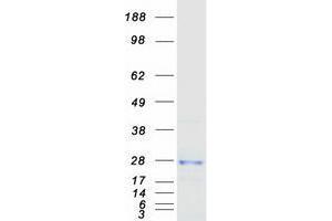 Validation with Western Blot