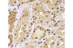 Immunohistochemistry of paraffin-embedded Human kidney using PHF21B Polyclonal Antibody at dilution of 1:100 (40x lens).