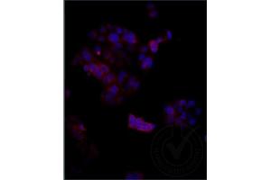 Independently Validated Antibody, image provided by Science Direct, badge number 029611:Formalin-fixed MCF7 cells labeled with Anti-Megalin Polyclonal Antibody, Cy3 Conjugated (ABIN750991) at 1:250 overnight at 4C.