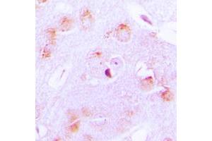 Immunohistochemical analysis of Cytochrome P450 17A1 staining in human brain formalin fixed paraffin embedded tissue section.